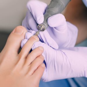 Verschillende behandelingen bij Pedicure Hellen zijn mogelijk